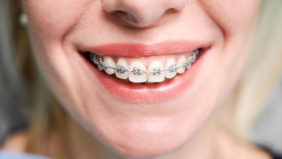 When to See An Orthodontist